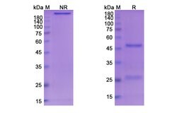Invitrogen Serclutamab Chimeric Recombinant Human Monoclonal Antibody 100