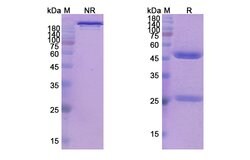 Balstilimab Recombinant Human Monoclonal Antibody:Antibodies, Recombinant
