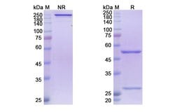 Invitrogen Atoltivimab Recombinant Human Monoclonal Antibody 100 &mu;g | Buy Online | Invitrogen&trade; | Fisher Scientific