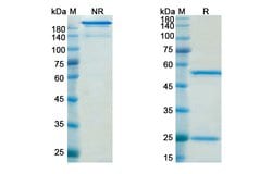 Invitrogen Quetmolimab Chimeric Recombinant Human Monoclonal Antibody 100 &mu;g | Buy Online | Invitrogen&trade; | Fisher Scientific