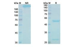 Invitrogen Cinpanemab Humanized Recombinant Human Monoclonal Antibody 100 &mu;g | Buy Online | Invitrogen&trade; | Fisher Scientific