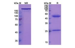 Invitrogen Disitamab Humanized Recombinant Human Monoclonal Antibody 100