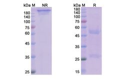 Invitrogen Avdoralimab Recombinant Human Monoclonal Antibody 100 &mu;g | Buy Online | Invitrogen&trade; | Fisher Scientific
