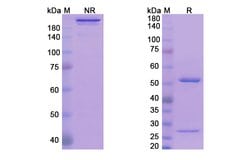 Invitrogen Avizakimab Humanized Recombinant Human Monoclonal Antibody 100