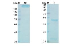 Invitrogen Batoclimab Recombinant Human Monoclonal Antibody 100 &mu;g | Buy Online | Invitrogen&trade; | Fisher Scientific