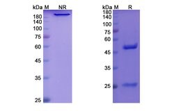 Invitrogen Benufutamab Chimeric Recombinant Human Monoclonal Antibody 100