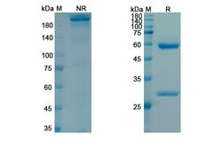 Invitrogen Lodapolimab Recombinant Human Monoclonal Antibody 100 μg;