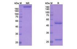 Invitrogen Nurulimab Recombinant Human Monoclonal Antibody 100 &mu;g; Unconjugated:Antibodies,