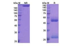 Invitrogen Odesivimab Recombinant Human Monoclonal Antibody 100 &mu;g | Buy Online | Invitrogen&trade; | Fisher Scientific