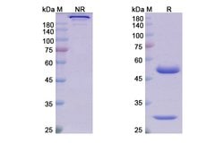 Invitrogen Tilvestamab Humanized Recombinant Human Monoclonal Antibody 100 &mu;g | Buy Online | Invitrogen&trade; | Fisher Scientific