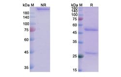 Invitrogen Tinurilimab Humanized Recombinant Human Monoclonal Antibody 100 &mu;g | Buy Online | Invitrogen&trade; | Fisher Scientific