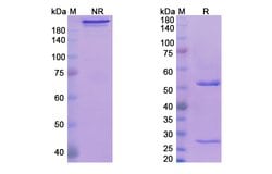Invitrogen Tavolimab Recombinant Human Monoclonal Antibody 100 &mu;g | Buy Online | Invitrogen&trade; | Fisher Scientific