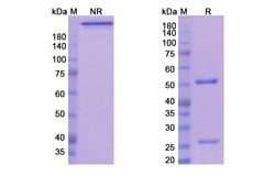 Invitrogen Teplizumab Humanized Recombinant Human Monoclonal Antibody 100 &mu;g | Buy Online | Invitrogen&trade; | Fisher Scientific
