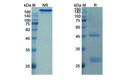 Bamlanivimab Recombinant Human Monoclonal Antibody, Invitrogen 100 &mu;g;
