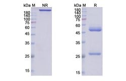 Invitrogen Etesevimab Humanized Recombinant Human Monoclonal Antibody 100
