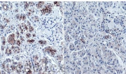 Invitrogen CA19-9 Monoclonal Antibody (GT933) 100 &mu;L; Unconjugated:Antibodies,