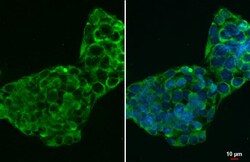 Invitrogen CTGF Monoclonal Antibody (GT28711) 100 &mu;L; Unconjugated:Antibodies,