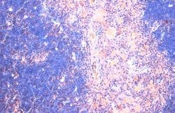 Invitrogen CTGF Monoclonal Antibody (GT28711) 100 &mu;L; Unconjugated:Antibodies,
