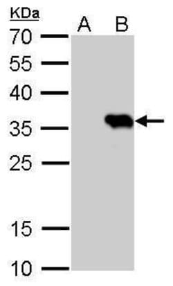 Invitrogen HSV Tag Monoclonal Antibody (GT223) 100 &mu;L | Buy Online | Invitrogen&trade; | Fisher Scientific
