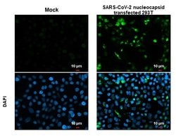 Invitrogen SARS/SARS-CoV-2 Nucleocapsid Monoclonal Antibody (GT113) 100 &mu;L | Buy Online | Invitrogen&trade; | Fisher Scientific