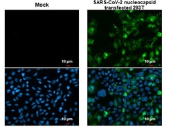 Invitrogen SARS/SARS-CoV-2 Nucleocapsid Monoclonal Antibody (GT113) 100 &mu;L | Buy Online | Invitrogen&trade; | Fisher Scientific