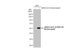 Invitrogen SARS/SARS-CoV-2 Nucleocapsid Monoclonal Antibody (GT113) 100 &mu;L | Buy Online | Invitrogen&trade; | Fisher Scientific