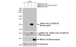 Invitrogen SARS/SARS-CoV-2 Nucleocapsid Monoclonal Antibody (GT113) 100 &mu;L | Buy Online | Invitrogen&trade; | Fisher Scientific