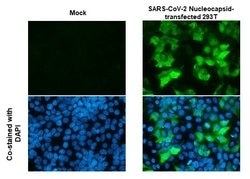 Invitrogen SARS/SARS-CoV-2 Nucleocapsid Recombinant Mouse Monoclonal Antibody