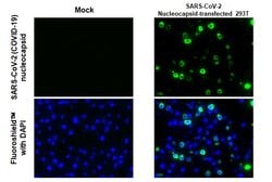 Invitrogen SARS/SARS-CoV-2 Nucleocapsid Recombinant Mouse Monoclonal Antibody