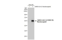 Invitrogen SARS/SARS-CoV-2 Nucleocapsid Recombinant Mouse Monoclonal Antibody
