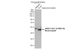 Invitrogen SARS/SARS-CoV-2 Nucleocapsid Recombinant Mouse Monoclonal Antibody