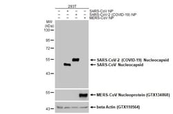 Invitrogen SARS/SARS-CoV-2 Nucleocapsid Recombinant Mouse Monoclonal Antibody
