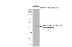 Invitrogen SARS/SARS-CoV-2 Nucleocapsid Recombinant Mouse Monoclonal Antibody