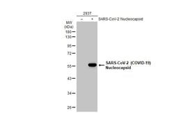 Invitrogen SARS/SARS-CoV-2 Nucleocapsid Recombinant Mouse Monoclonal Antibody