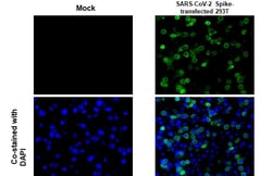 Invitrogen SARS/SARS-CoV-2 Spike Protein S2 Monoclonal Antibody (GT8110)