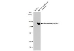 Invitrogen Thrombospondin 2 Monoclonal Antibody (GT147) 100 &mu;L | Buy Online | Invitrogen&trade; | Fisher Scientific