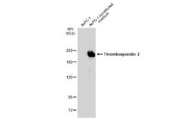 Invitrogen Thrombospondin 2 Monoclonal Antibody (GT7511) 100 &mu;L; Unconjugated:Antibodies,