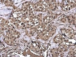Invitrogen Ubiquitin Monoclonal Antibody (GT7811) 100 &mu;L; Unconjugated:Antibodies,