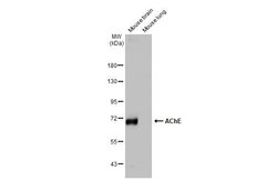Invitrogen Acetylcholinesterase Recombinant Rabbit Monoclonal Antibody (HL1102) 100 &mu;L | Buy Online | Invitrogen&trade; | Fisher Scientific