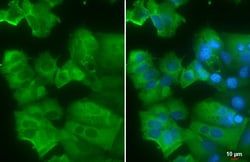 Invitrogen AGR2 Recombinant Rabbit Monoclonal Antibody (HL1024) 100 &mu;L;