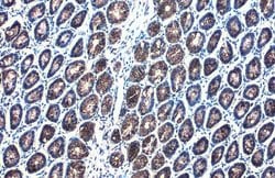 Invitrogen AGR2 Recombinant Rabbit Monoclonal Antibody (HL1024) 100 &mu;L;