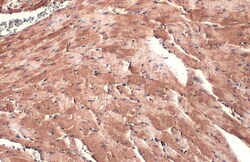Invitrogen DDR2 Recombinant Rabbit Monoclonal Antibody (HL1107) 100 &mu;L;