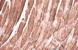 Invitrogen DDR2 Recombinant Rabbit Monoclonal Antibody (HL1107) 100 &mu;L;