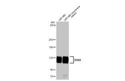 Invitrogen DDR2 Recombinant Rabbit Monoclonal Antibody (HL1107) 100 &mu;L;
