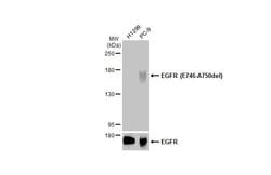 Invitrogen EGFR (E746-A750del) Recombinant Rabbit Monoclonal Antibody (HL363)