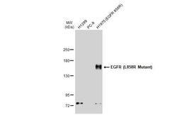 Invitrogen EGFR (L858R Mutant) Recombinant Rabbit Monoclonal Antibody (HL1022)