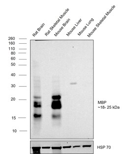Invitrogen MBP Recombinant Rabbit Monoclonal Antibody (HL1033) 100 &mu;L | Buy Online | Invitrogen&trade; | Fisher Scientific
