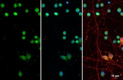 Invitrogen&trade;&nbsp;OLIG2 Recombinant Rabbit Monoclonal Antibody (HL1072)