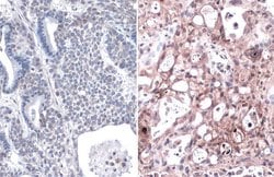 Invitrogen K-Ras (G12V Mutant) Recombinant Rabbit Monoclonal Antibody (HL169) 100 &mu;L | Buy Online | Invitrogen&trade; | Fisher Scientific