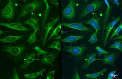 Invitrogen Phospho-ROCK2 (Ser1366) Recombinant Rabbit Monoclonal Antibody